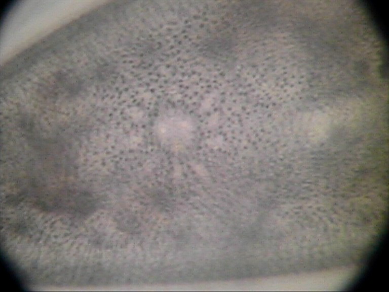 Vacuolo pulsante e ampolle dei canali radiali di Paramecium